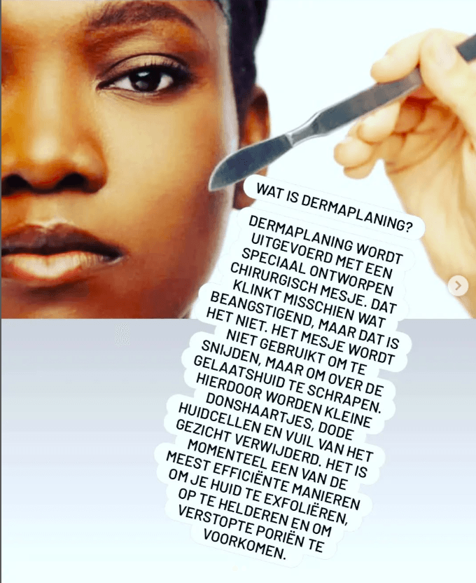 Uitleg over dermaplaning, een behandeling met een speciaal ontworpen mesje